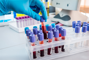 Gestion incidents biologiques